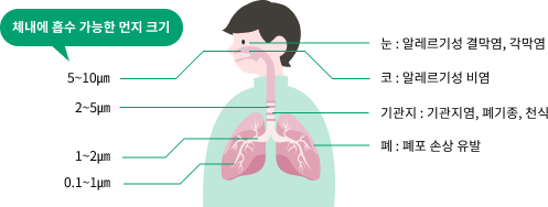 체내에 흡수 가능한 먼지크기, 눈: 알레르기성 결막염, 각막염(5~10㎛), 코 : 알레르기성 비염(2-5㎛), 기관지 : 기관지염, 폐기종, 천식(1~2㎛), 폐 : 폐포 손상 유발(0.1~1㎛)